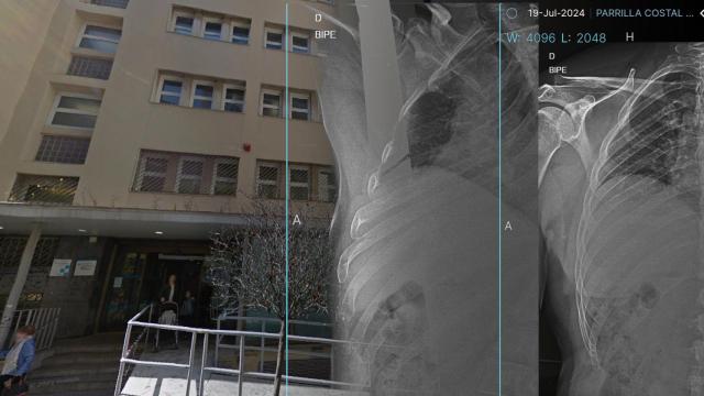 Las dos radiografías perdidas y el CAP Granollers Centre, donde pasaron los hechos